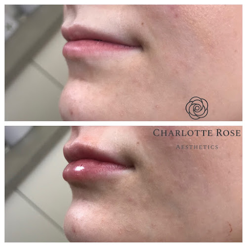 Comments and reviews of Charlotte Rose Aesthetics