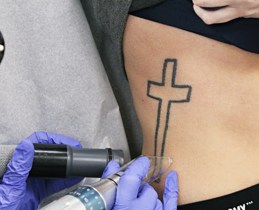 Explore lion and the lamb tattoo ideas, creative tattoo ideas in Amarillo, available at Progress MD Tattoo Removal