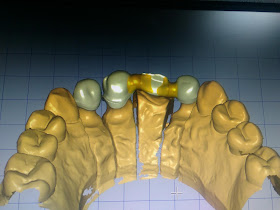 Germany Dental Lab - Laboratorio Dental