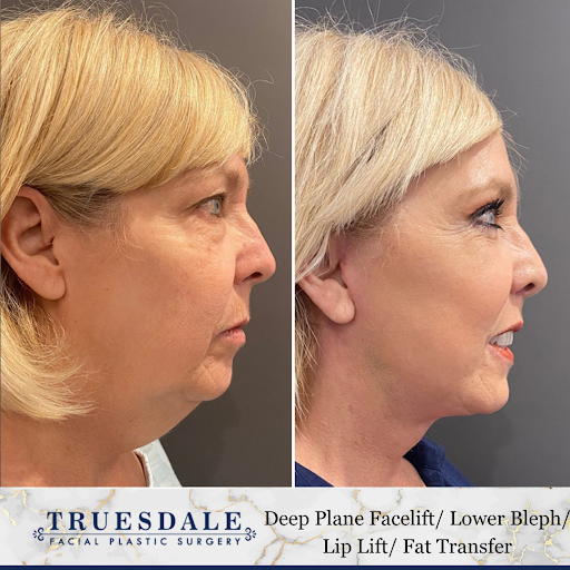 Truesdale Facial Plastic Surgery image
