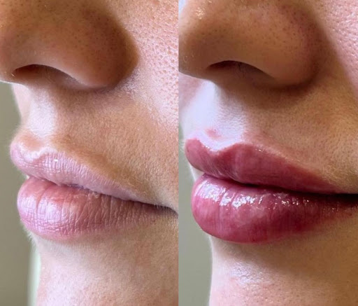 Explore chest tattoo ideas for men, creative tattoo ideas in Princeton Junction, available at Princeton Aesthetics