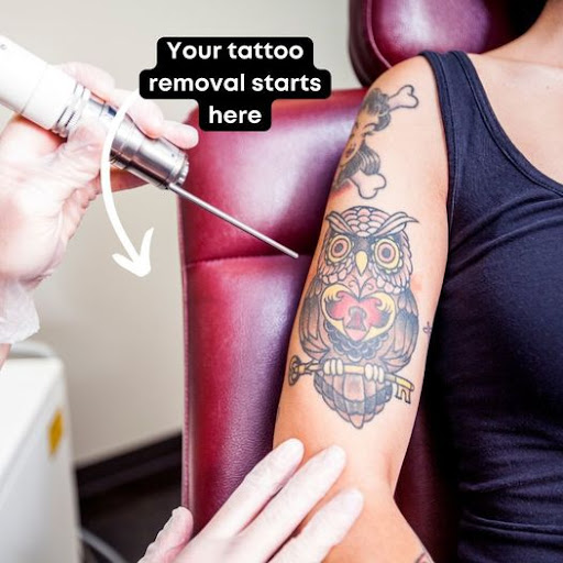 Explore sunshine tattoos ideas, creative tattoo ideas in Morrisville, available at Regerts Ink Removal