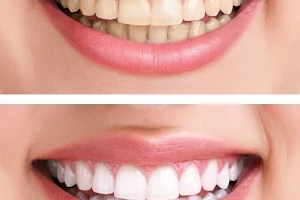 Jaws and Teeth Dental Clinic, Kelambakkam changing to Kings Crown Dentistry image