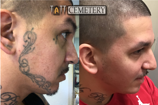 Explore wedding ring tattoo cover up ideas, creative tattoo ideas in Fort Myers, available at Laser Tattoo Removal by Tatt Cemetery
