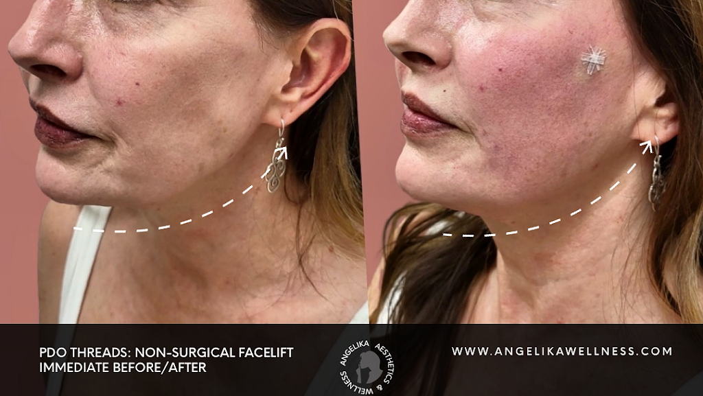 Angelika Aesthetics & Wellness 32136