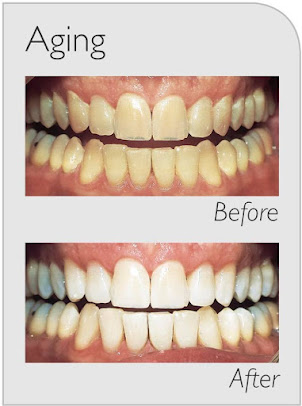 مراكز ابتسامة سيدني - Sydney Smile Centres