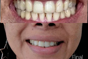 Clinica dental Beauty Dental / puentes dentales image