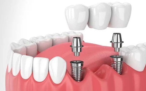 TruSmiles Family Dental Clinic & Implant Centre image