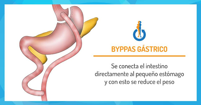 Dr. Ramiro Guadalupe - Team Bariátrico - Cirugía Bariátrica Quito - Cirugía de Obesidad - Manga Gástrica - Médico