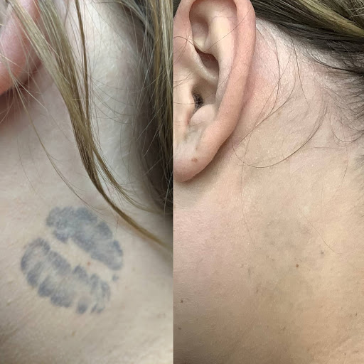 Explore zoro tattoo ideas, creative tattoo ideas in Easton, available at Precision Laser LLC