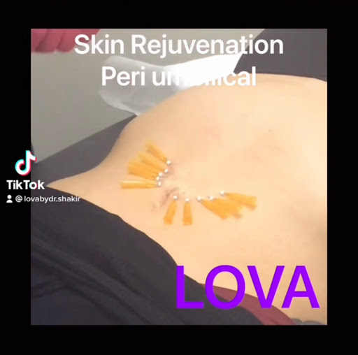 Explore batman sleeve tattoo ideas, creative tattoo ideas in Lake Oswego, available at Lake Oswego Vein and Aesthetic LOVA