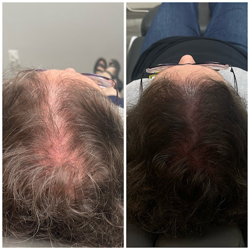 Explore osiris tattoo ideas, creative tattoo ideas in Roseville, available at NuHair Ink. Scalp MicroPigmentation & Aesthetic Clinic of Sacramento