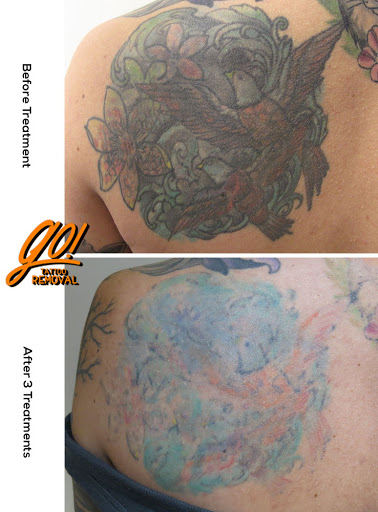 Explore japanese tattoo idea, creative tattoo ideas in Allentown, available at Removery Tattoo Removal & Fading