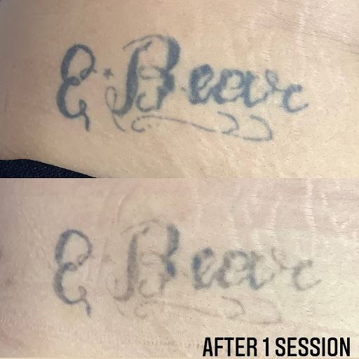 Explore upper back tattoo ideas for men, creative tattoo ideas in Easton, available at Precision Laser LLC