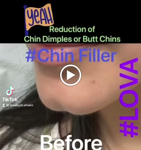 Explore duck tattoo ideas, creative tattoo ideas in Lake Oswego, available at Lake Oswego Vein and Aesthetic LOVA