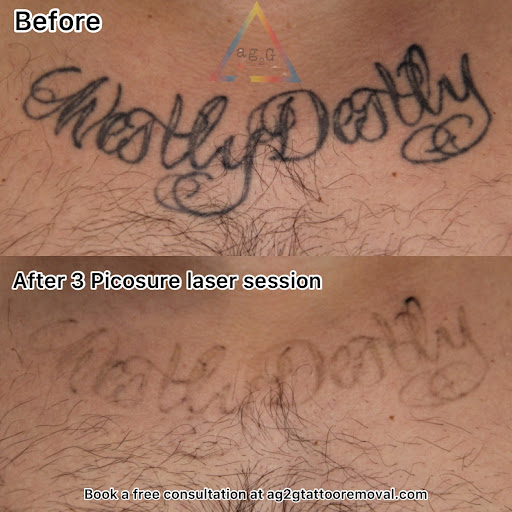 Explore alaska tattoo ideas, creative tattoo ideas in New York, available at Ag2g Laser Tattoo Removal & MedSpa