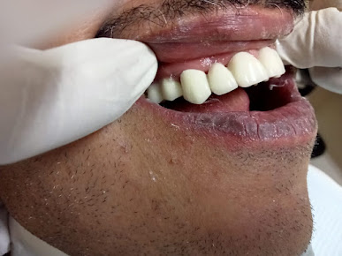 Panama Dental Lab - Panama Dental Lab