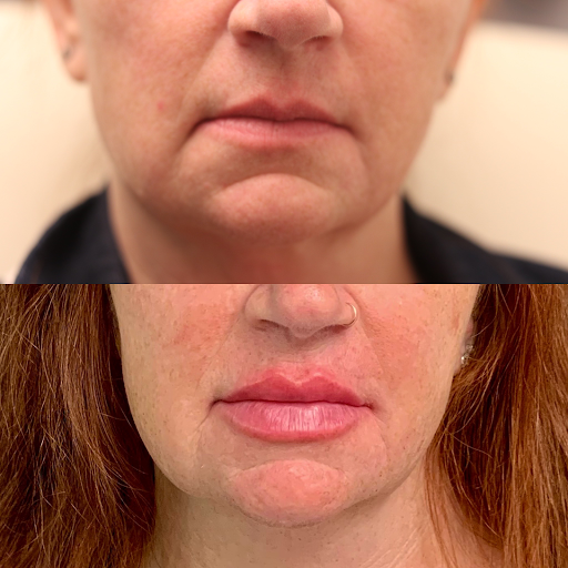 Explore bmo tattoo ideas, creative tattoo ideas in Summit, available at Ethos Aesthetics and Wellness, Laser Hair Removal and Med Spa