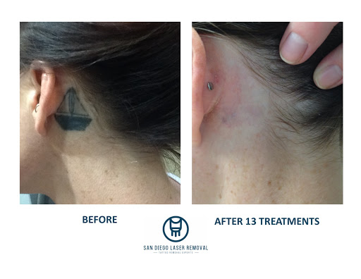 Find 3 best friend tattoo ideas for your next unique tattoo in San Diego at Removery Tattoo Removal & Fading