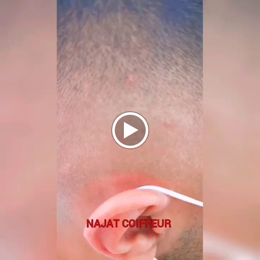 Küçük Resim 1