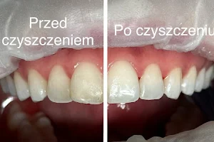 Alchemia Uśmiechu Gabinet Stomatologiczny -protetyka, implanty, ortodonta, dentysta warszawa image