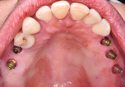 الجوهري لزراعه الأسنان - Gohary implant clinic - دكتور فَرج الجوهري