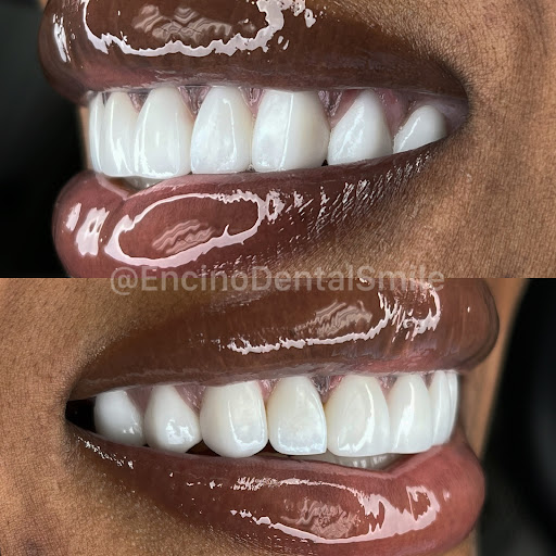 Encino Dental Smile image