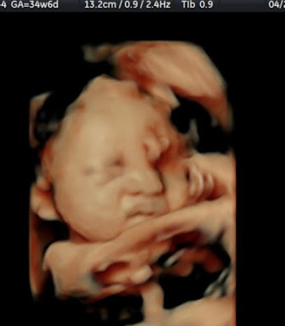 Early View Ultrasound