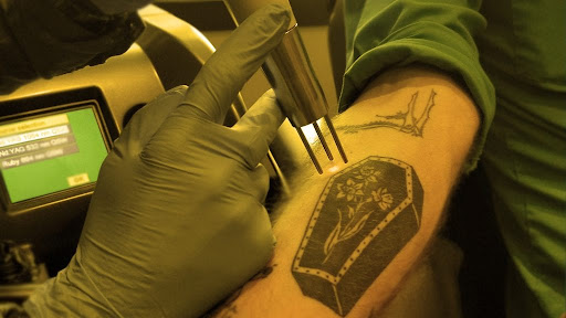 Explore married tattoo ideas, creative tattoo ideas in Lincoln, available at Fade Away Laser