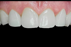 Dr. Pablo Guzmán. Estetica Dental - Implante Dental-Carillas- Diseño De sonrisa-Prótesis dentales image