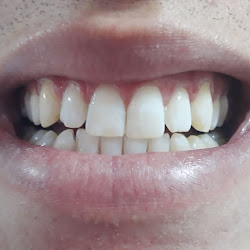 Odontowest Clínica Dentária