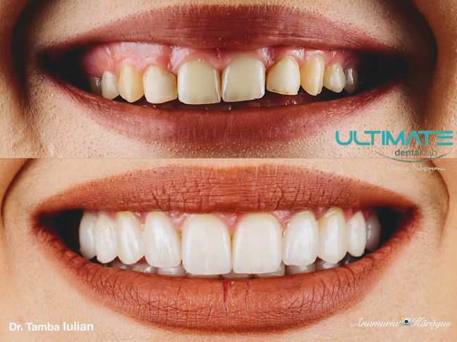 Ultimate Dental Lab - Dentist