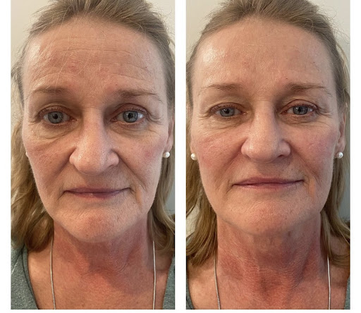 Medical Spa «Lavender Med Spa», reviews and photos, 3675 Crestwood Pkwy #400, Duluth, GA 30096, USA