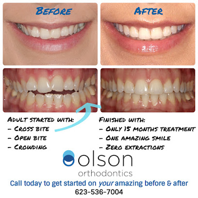 Olson Orthodontics - Chris Olson, DDS, MS - Verrado