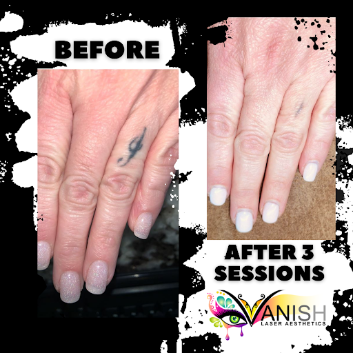 Explore samoan tattoo ideas, creative tattoo ideas in Longview, available at Vanish Laser Aesthetics