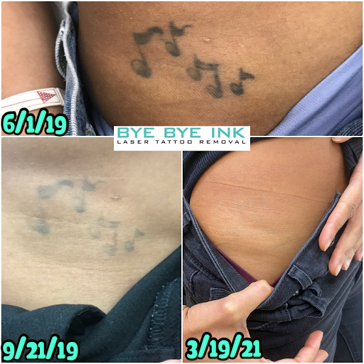 Explore autistic tattoo ideas, creative tattoo ideas in Middle Village, available at Bye Bye Ink Laser Tattoo Removal