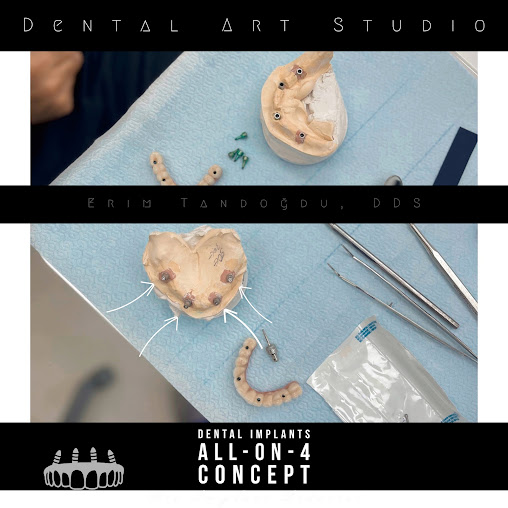 DentART - DentART
