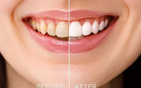 Aksu Özel Beyaz Ağız ve Diş Sağlığı Polikliniği image