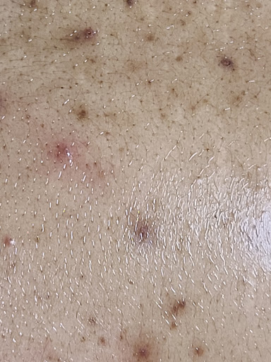 Facial Spa «Beauty Oasis Rx Facial Clinic», reviews and photos, 977 Raintree Cir #220, Allen, TX 75013, USA