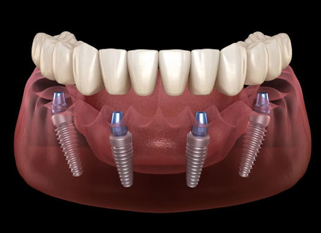Opinii despre Clinica Dentara DENTA MAX -Dr Cioban în <nil> - Dentist