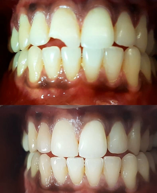 Dental Solutions - by Dr Komal Padman - Dental Solutions - by Dr Komal Padman