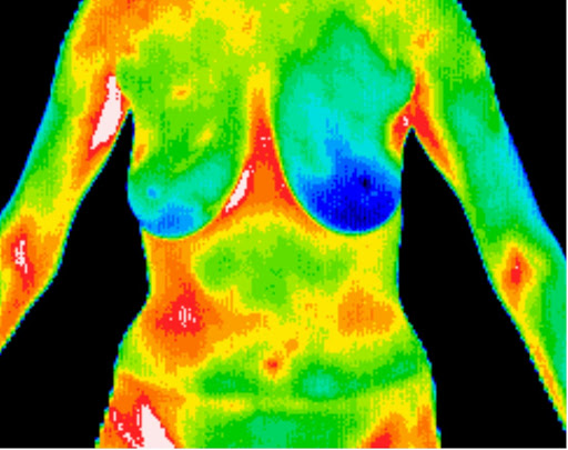 East Valley Thermography