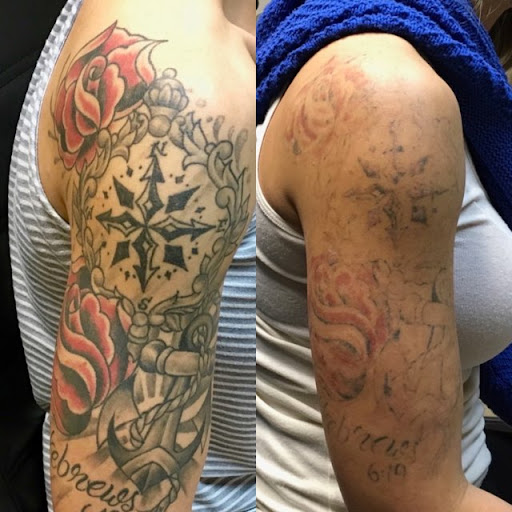 Explore first tattoo ideas for black females, creative tattoo ideas in Lawton, available at Clean Canvas Tattoo Removal