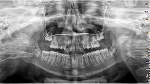عيادة إزميرديس لصحة الفم والأسنان - Izmirdis Oral and Dental Health Polyclinic