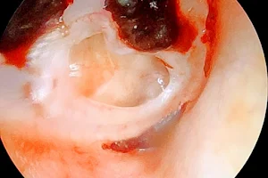 Kavya ENT Clinic (Advanced Ear Nose Throat and Endoscopy Centre) image