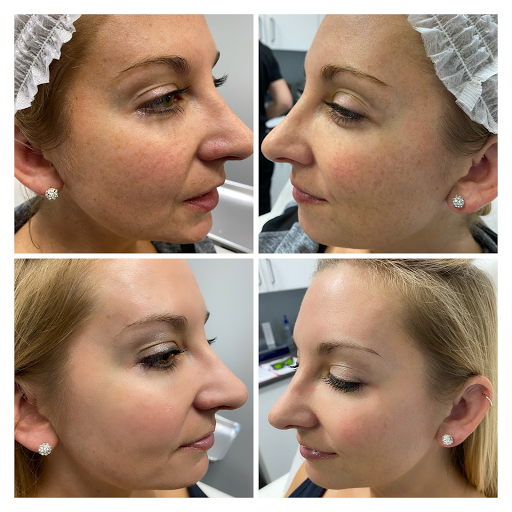 Explore wanderlust tattoo ideas, creative tattoo ideas in Tampa, available at Luminous Skin and Laser