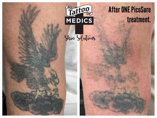 Explore watercolor tattoo ideas for females, creative tattoo ideas in Providence, available at TattooMedics Laser Tattoo Removal