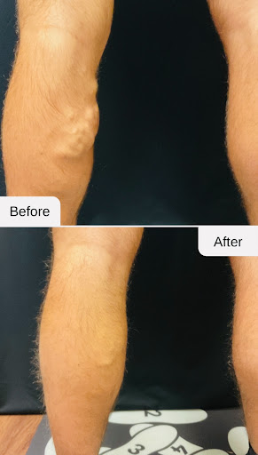 Explore tattoo ideas mushroom, creative tattoo ideas in Lake Oswego, available at Lake Oswego Vein and Aesthetic LOVA