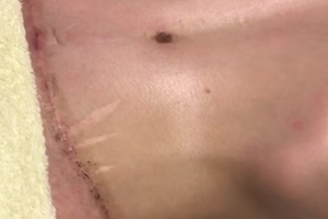 Terapiasles (especializada em Pós Operatório & cicatrizes)) image