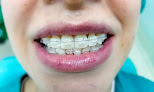 Premium Dental | Diseño de sonrisa, Ortodoncia e Implantes Dentales en Medellin